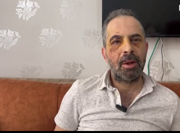 Konya’da köpek saldırısı! Ölümden döndü