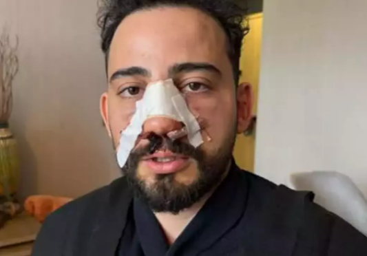 Siparişler geciktiği için gitmek isteyen müşteriyi darbettiler