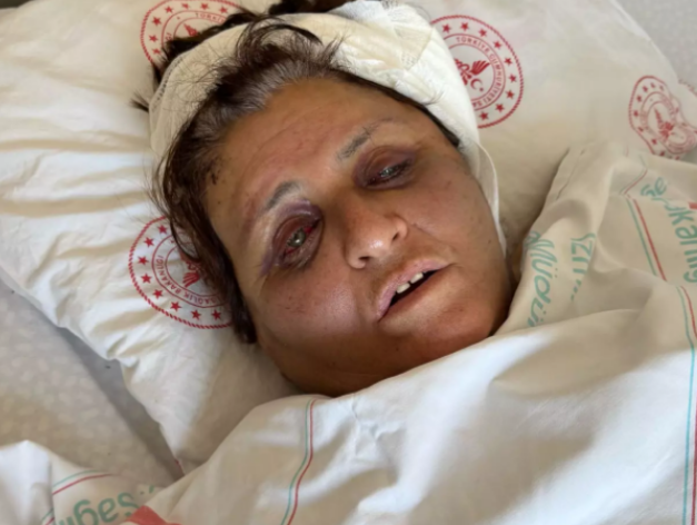 Yufka meselesi nedeniyle gelini tarafından komalık edildiği iddia edilen kadın uyandı!